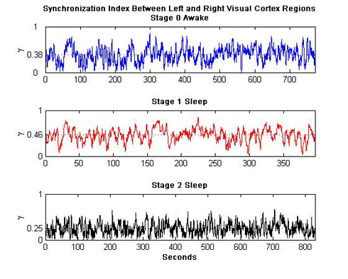 EEG/fMRI Correlation