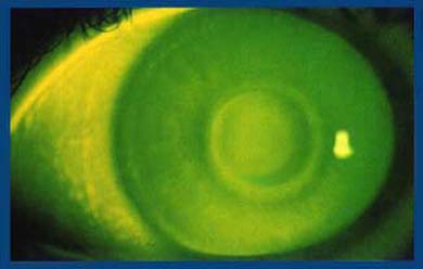 rgp.jpg (12377 bytes)